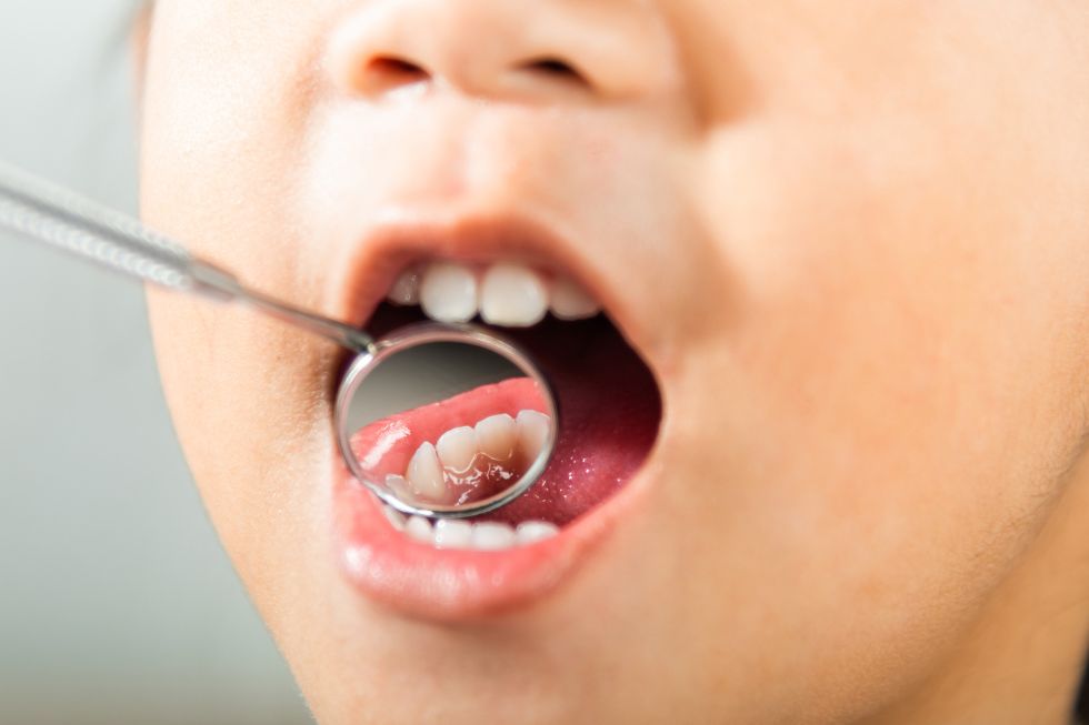 mitos salud dental