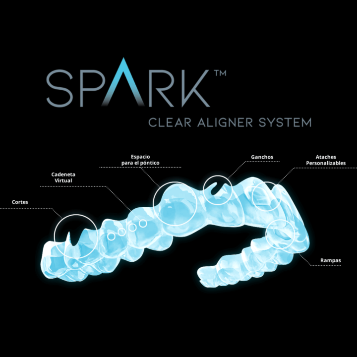 Nuestra ortodoncia Spark