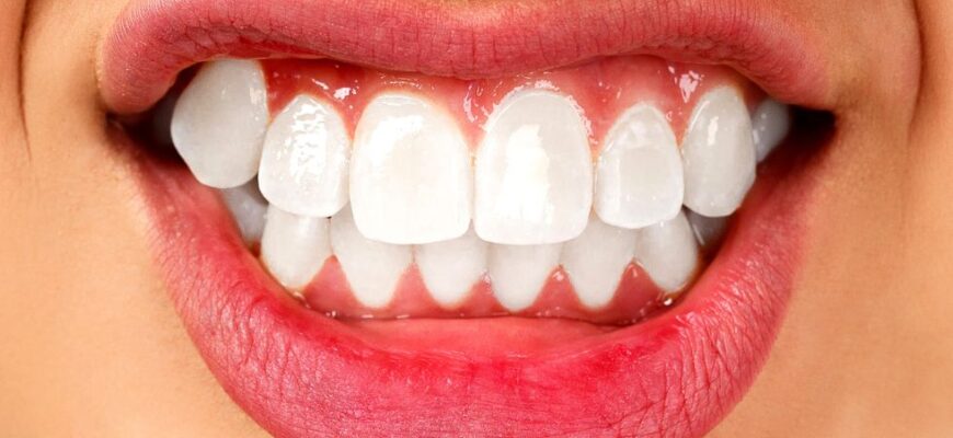 tratamiento bruxismo